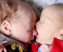 Anak Kembar Disebut Punya Kekuatan Telepati yang Kuat, Mitos atau Fakta?